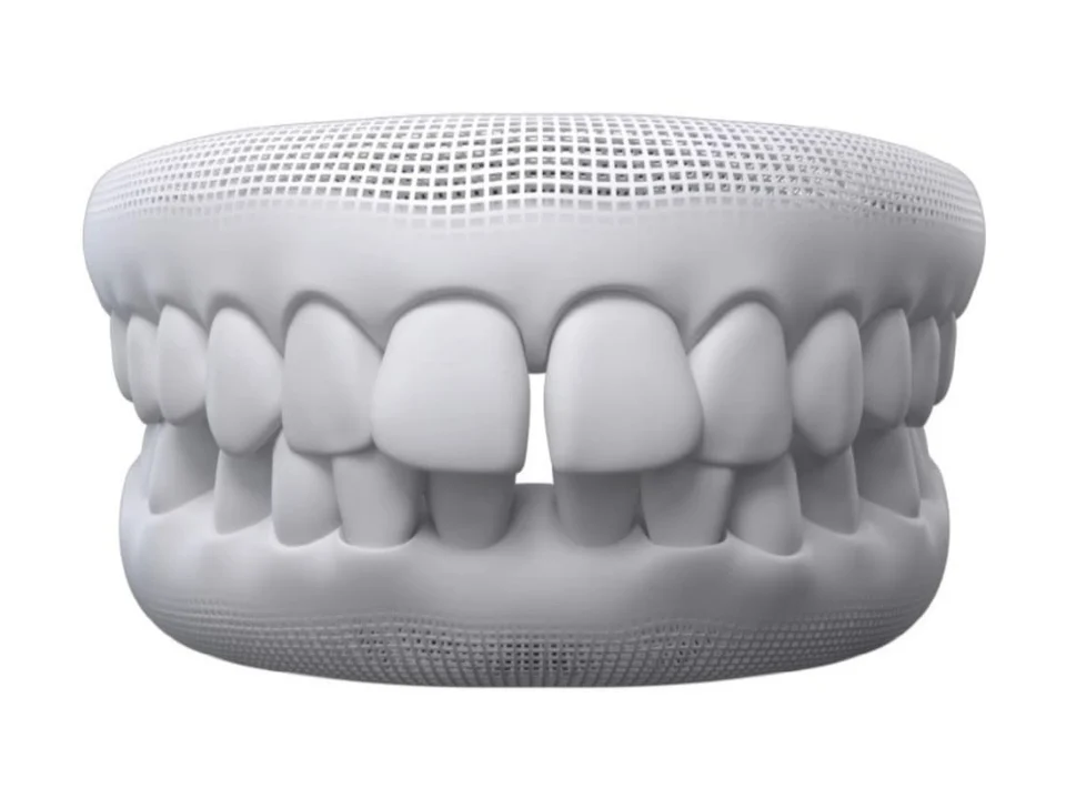 3D model of teeth showing gap teeth